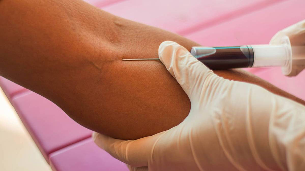 blood-drawn