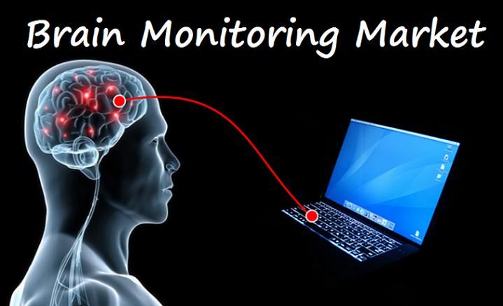 Brain monitoring market